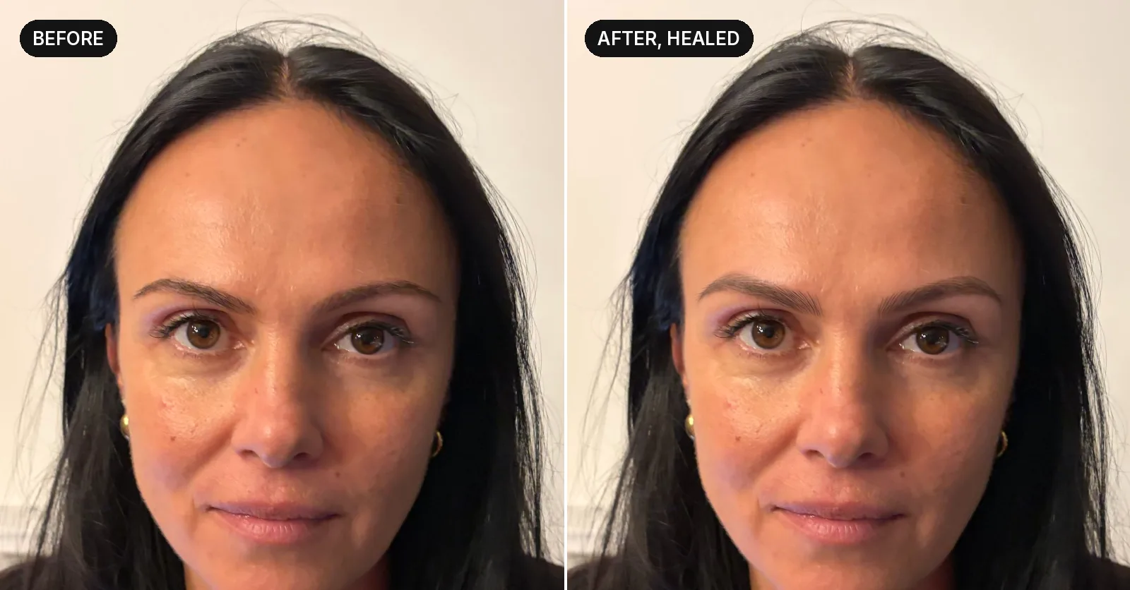 Her photo and her new brows, side by side: noticeable but natural